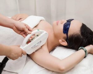 Dịch vụ triệt lông công nghệ Diode Laser 