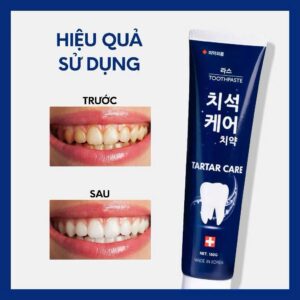 Kem đánh răng hiệu chỉnh màu 