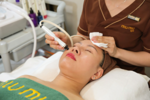 Aqua Peel tại Miu Miu Spa