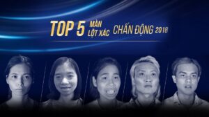 Show Hành trình lột xác của bệnh viện thẩm mỹ Kangnam