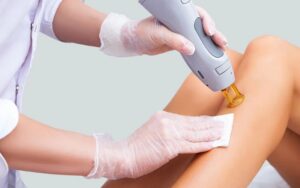 Triệt lông vĩnh viễn