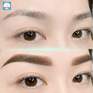 Phun xăm chân mày - Thẩm mỹ viện Hoài Anh