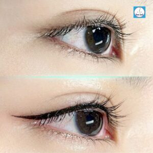 Phun mí đẹp tự nhiên tại thẩm mỹ viện Hoài Anh