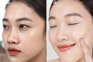 Thẩm Mỹ Viện Quốc Tế Linh Anh: Review chi tiết dịch vụ, bảng giá và trải nghiệm thực tế 2026