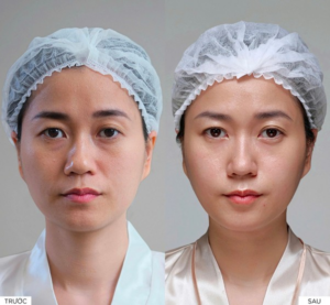 Thẩm Mỹ Viện Quốc Tế Linh Anh: Review chi tiết dịch vụ, bảng giá và trải nghiệm thực tế 2026