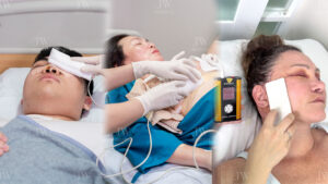 Máy Plasma lạnh - Bệnh viện thẩm mỹ KW Hàn Quốc