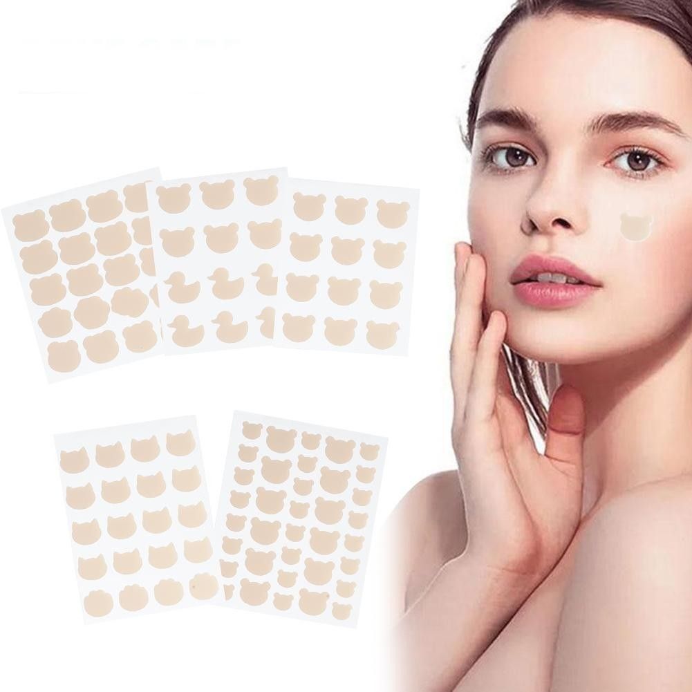 Cách làm xẹp mụn sưng đỏ sau 1 đêm hiệu quả và an toàn