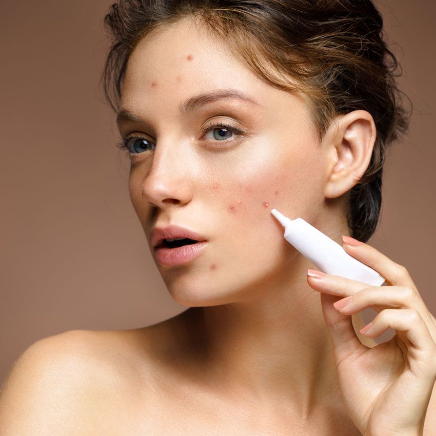 Cách làm xẹp mụn sưng đỏ sau 1 đêm hiệu quả và an toàn