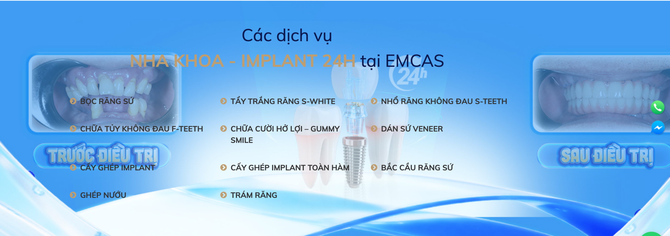 Bệnh viện Thẩm mỹ EMCAS có tốt không? Review trải nghiệm dịch vụ & Bảng giá mới nhất 2026