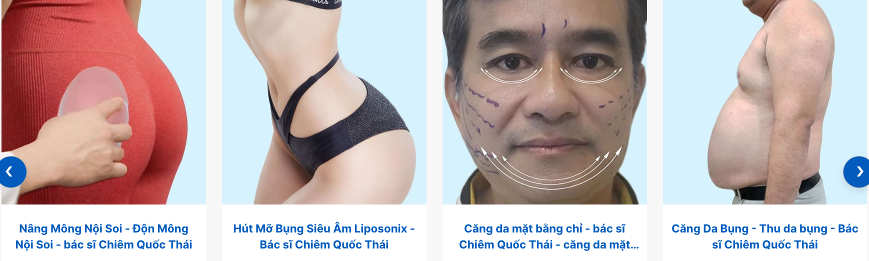 Bệnh viện Thẩm mỹ Việt Mỹ có uy tín không? Bảng giá 2026 & Review trải nghiệm khách hàng thực tế