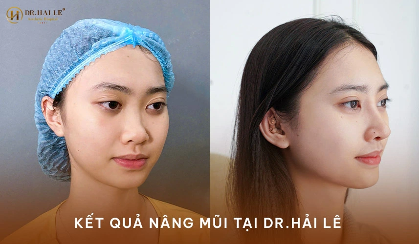 [2026] Bệnh viện Thẩm mỹ Dr Hải Lê có tốt không? Review chi tiết dịch vụ và trải nghiệm làm đẹp