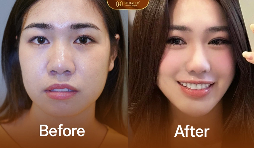 [2026] Bệnh viện Thẩm mỹ Dr Hải Lê có tốt không? Review chi tiết dịch vụ và trải nghiệm làm đẹp