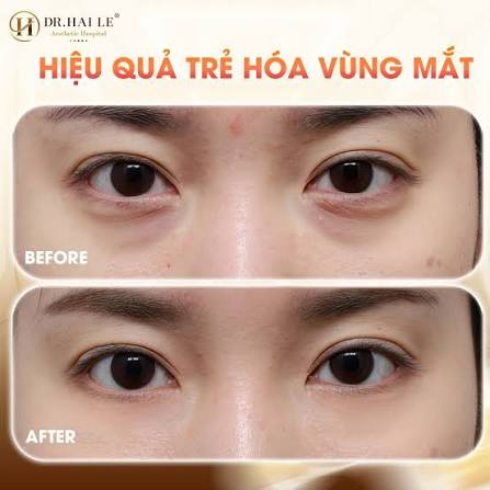 [2026] Bệnh viện Thẩm mỹ Dr Hải Lê có tốt không? Review chi tiết dịch vụ và trải nghiệm làm đẹp